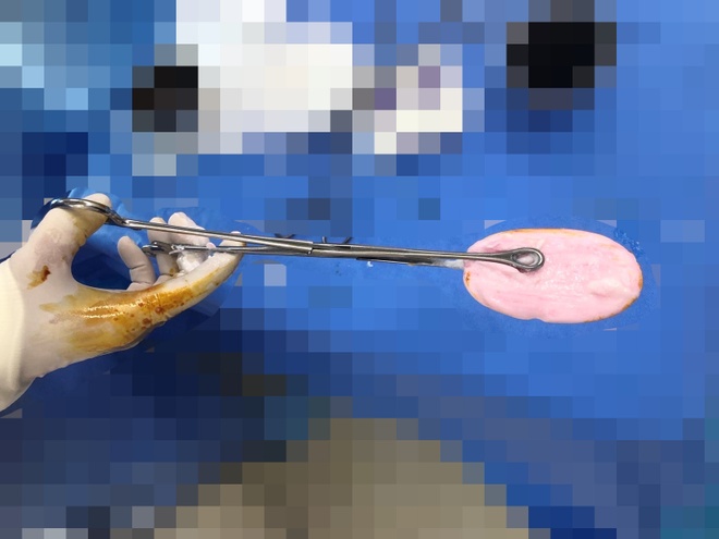 Vùng Kín Chảy Máu