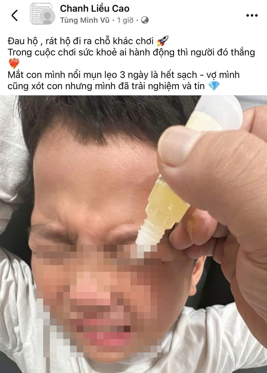 nho chanh vao mat anh 1