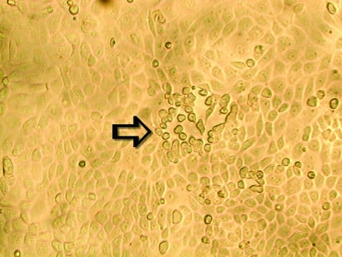 HMPV anh 2