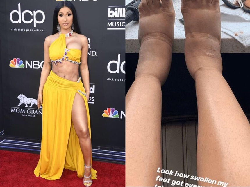 Cardi B phau thuat tham my anh 2