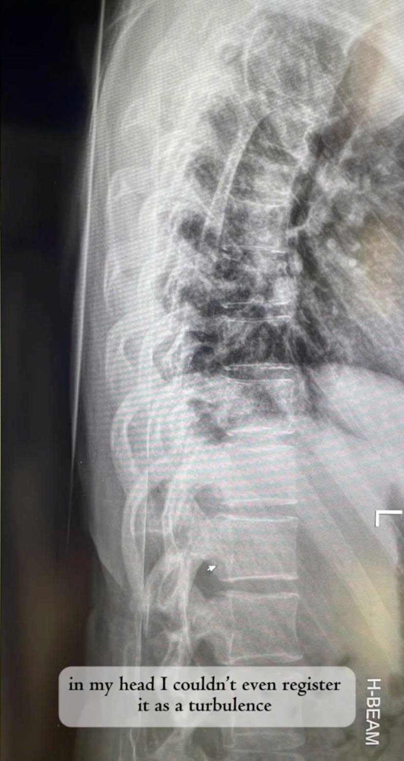 la het tren may bay anh 2