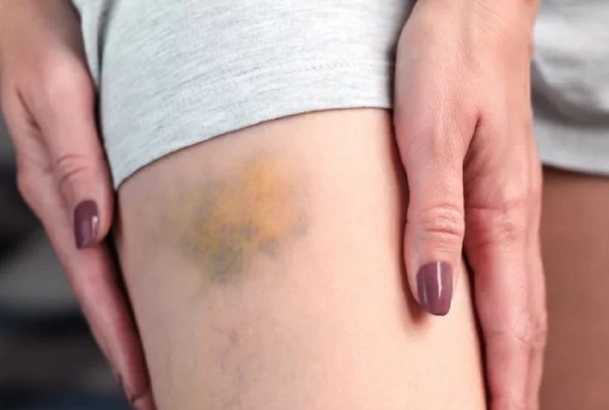 Dau hieu benh gan anh 1