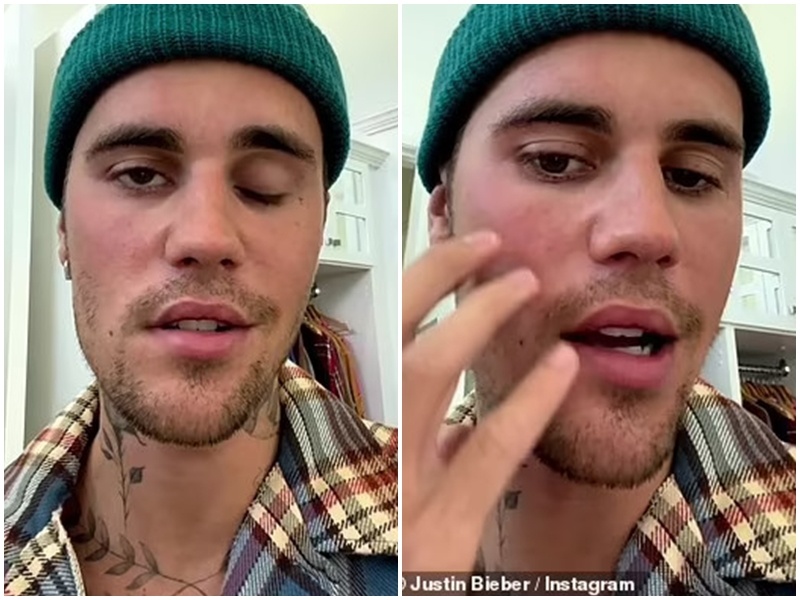 Justin Bieber anh 1