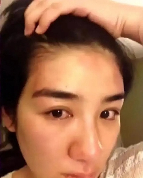 huynh dich bi chong cu bao hanh anh 2