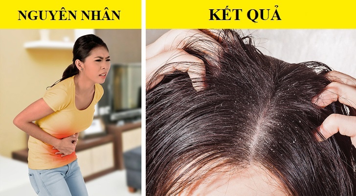 Bat thuong o mai toc anh 2