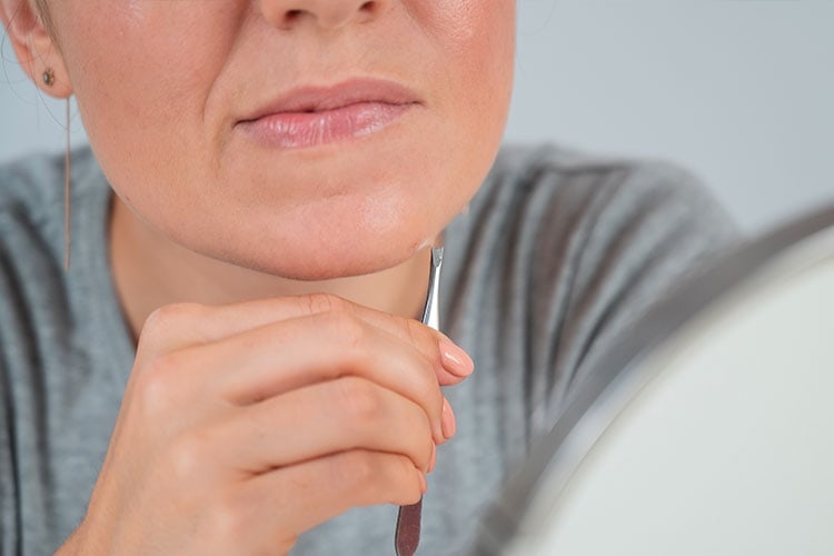 Dau hieu cua PCOS anh 4