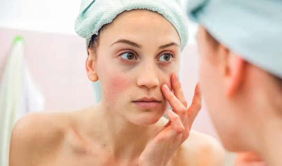 Bat thuong khi ngu day anh 3