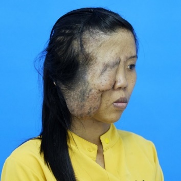 Benh vien tham my Kangnam anh 2